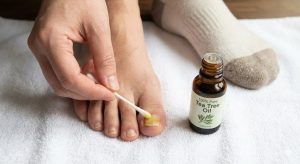 A person applying 100% pure tea tree oil using a cotton swab to a thickened, discolored toenail affected by fungus.