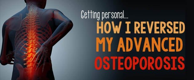 can-vitamin-d-reverse-osteoporosis-vitaminproguide